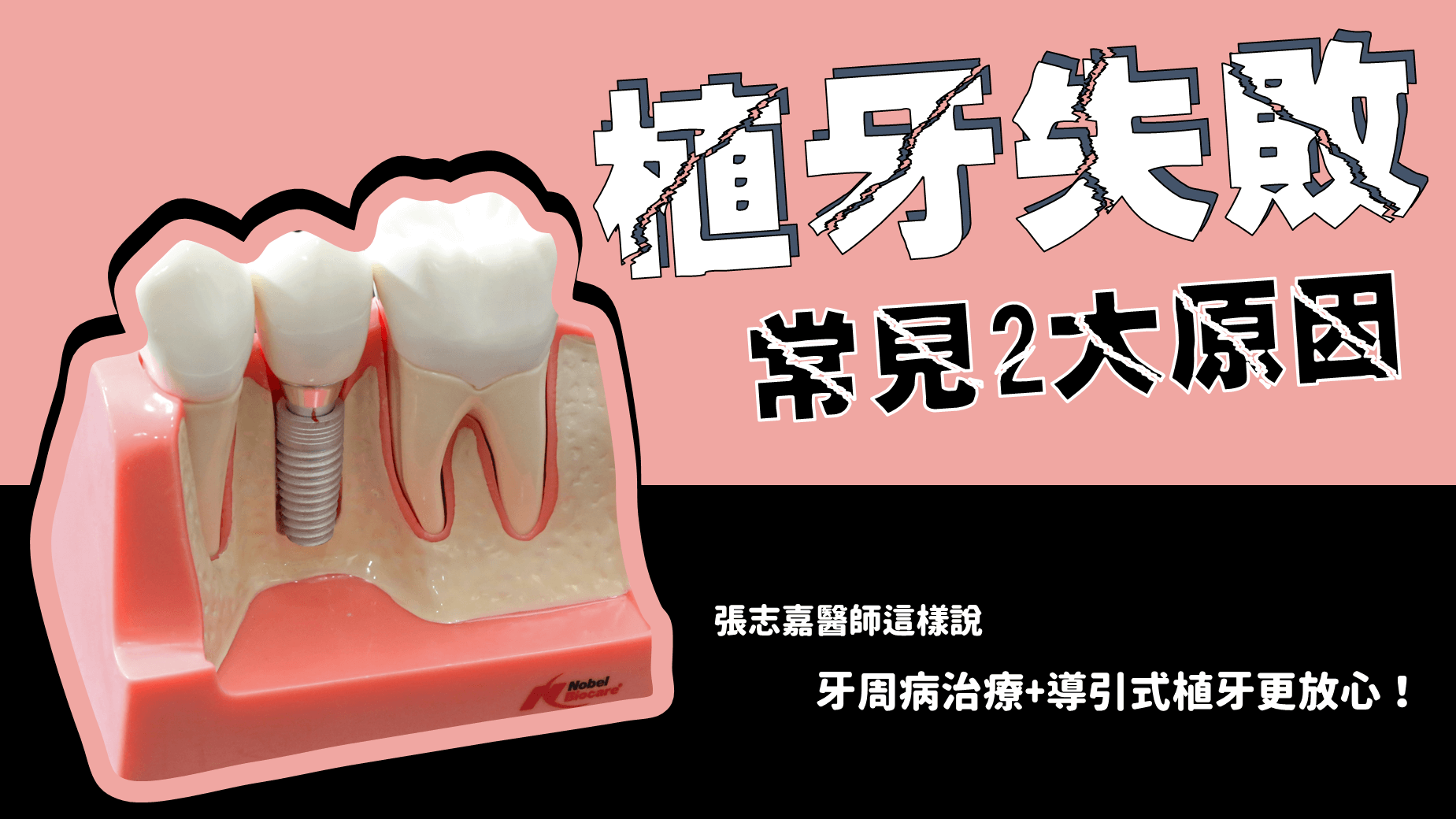 台灣植牙