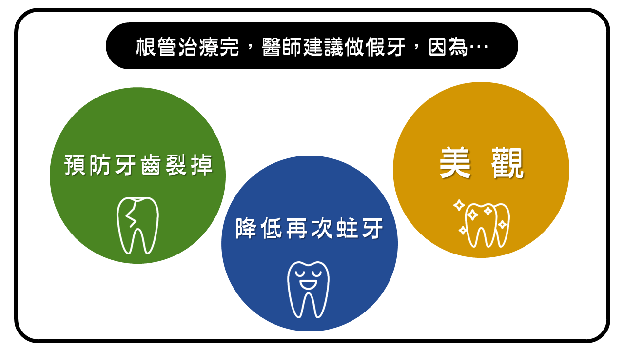 根管治療後建議做假牙的三大原因