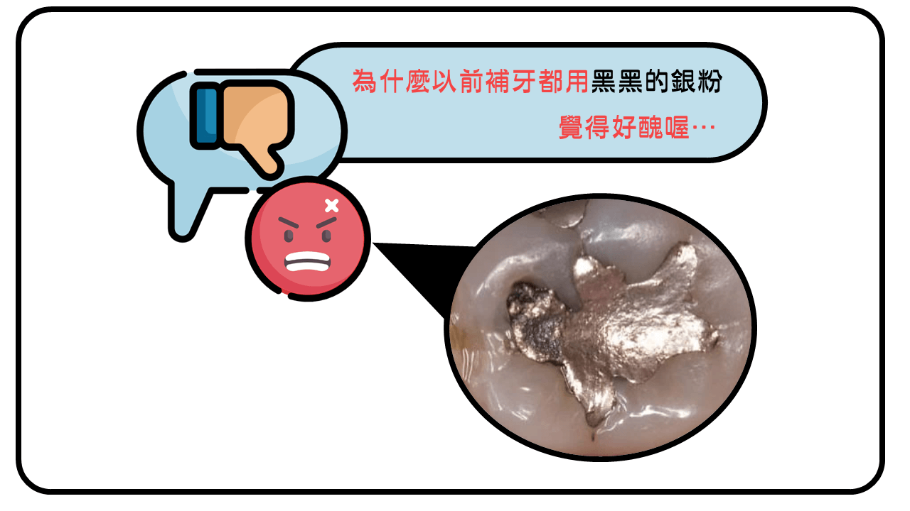 銀粉填補不美觀