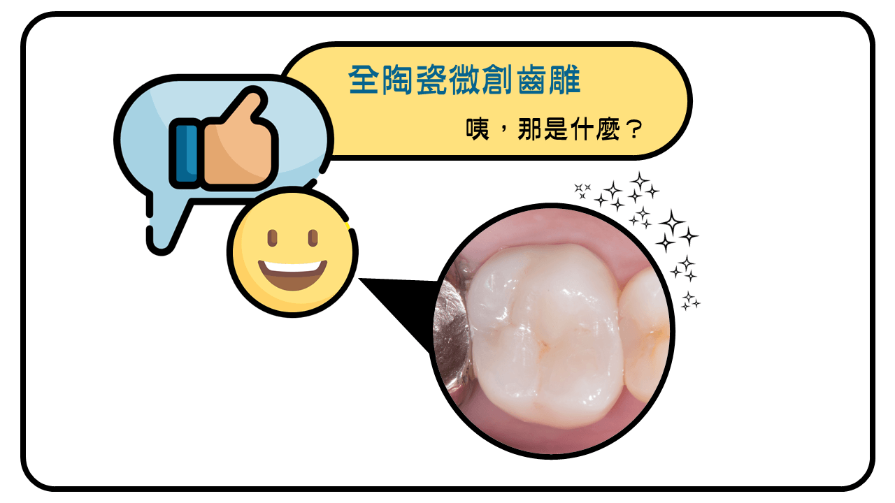 微創齒雕是現今填補的更好選擇