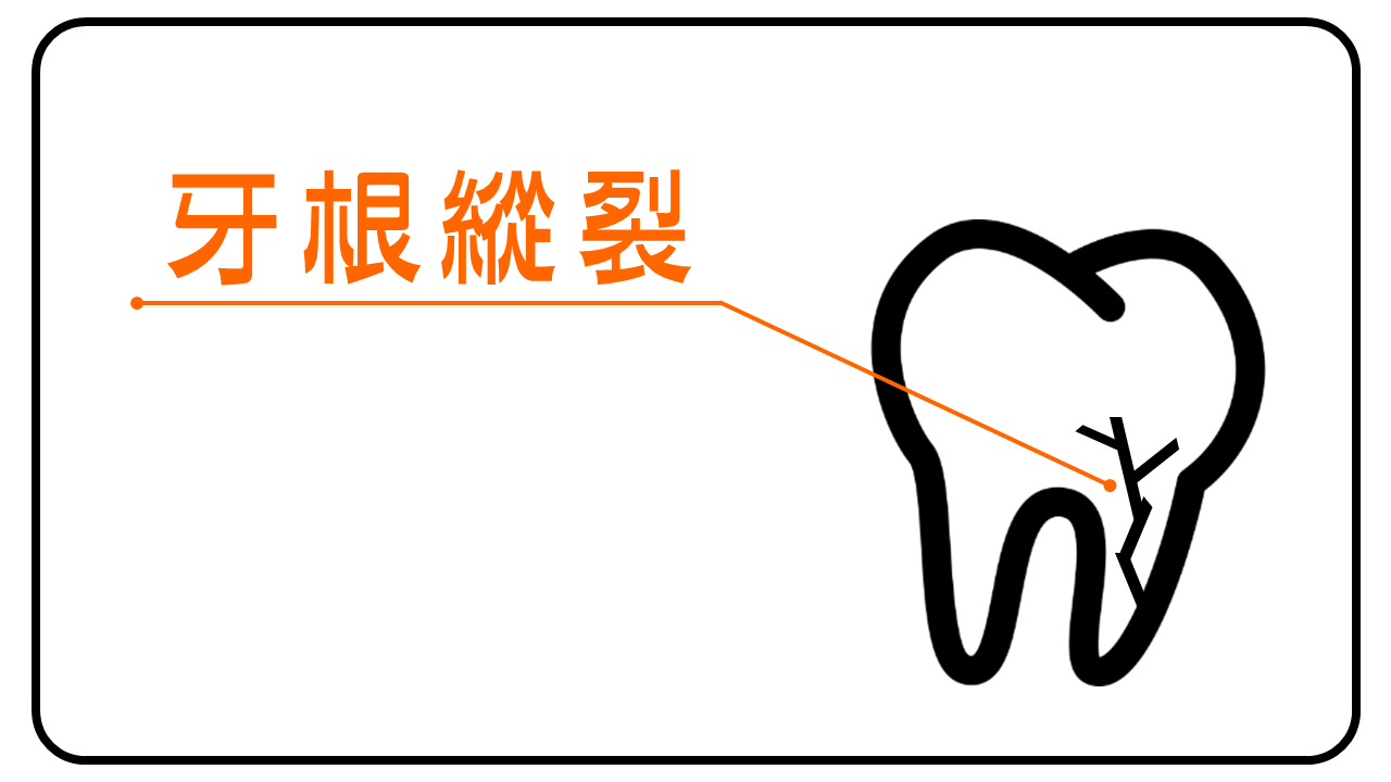 牙根縱裂