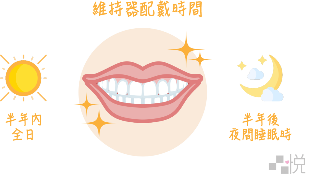 矯正牙齒拆掉牙套後要持續配戴維持器