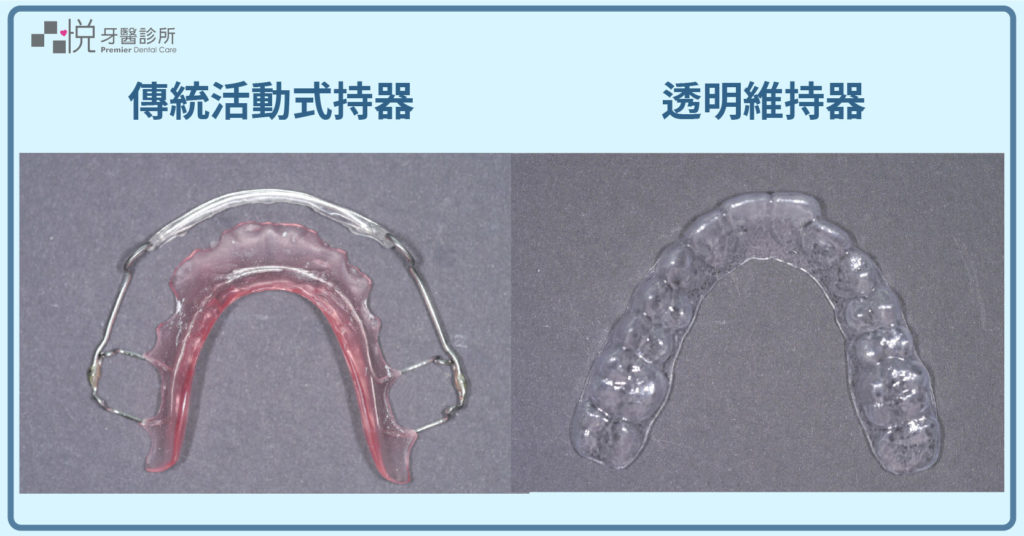 維持器照片