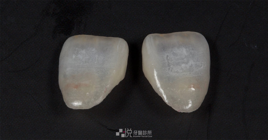 竹北高級陶瓷貼片透光的材質特性