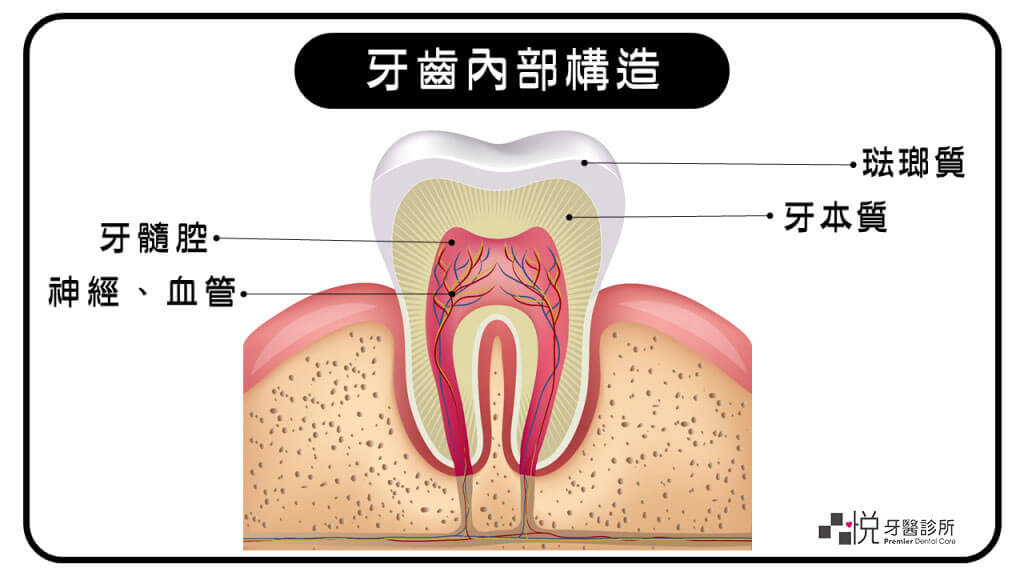牙齒構造側面剖面圖：珐瑯質、牙本質、牙髓腔